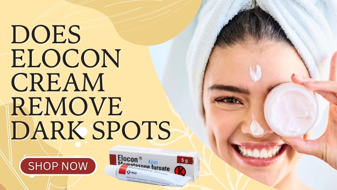 Does Elocon Cream Remove Dark Spots?